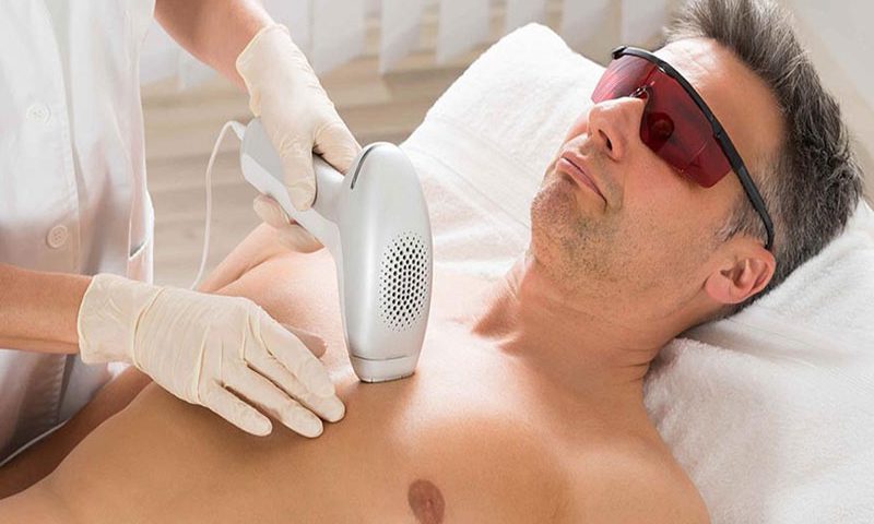 لیزر آقایان