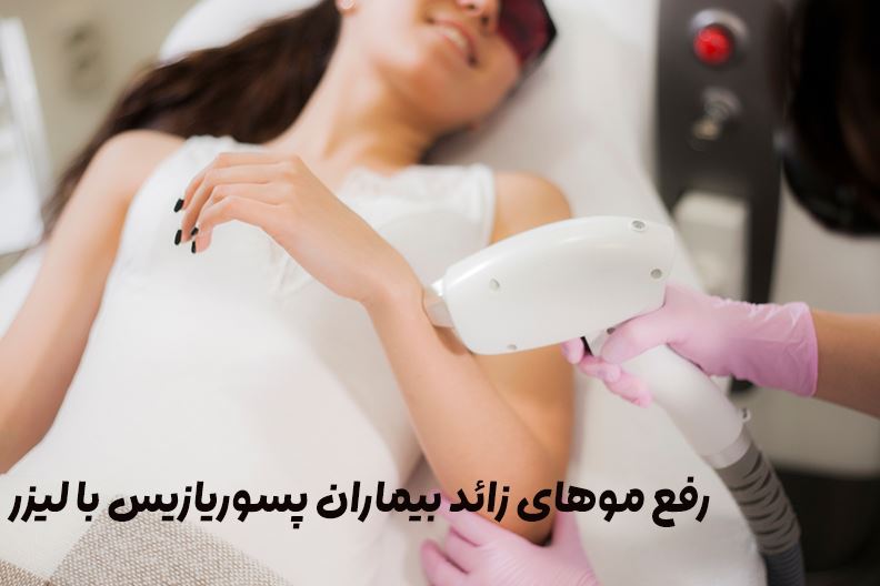 پسوریازیس و لیزر مو: بایدها و نبایدها